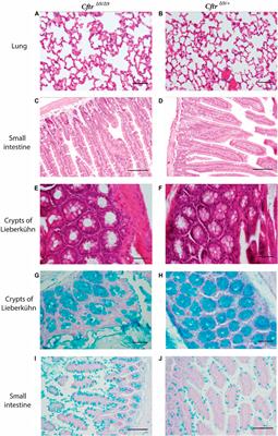 Investigating the Implications of CFTR Exon Skipping Using a Cftr Exon 9 Deleted Mouse Model